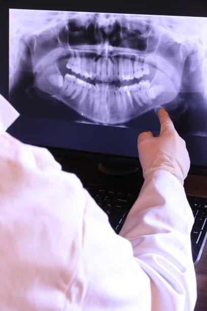 Best Emergency Gum Treatment in El Dorado Hills, CA