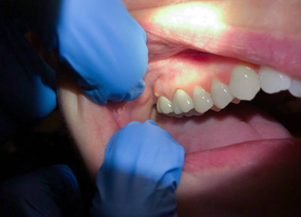 Best Cosmetic Emergency Dentistry in El Dorado Hills, CA
